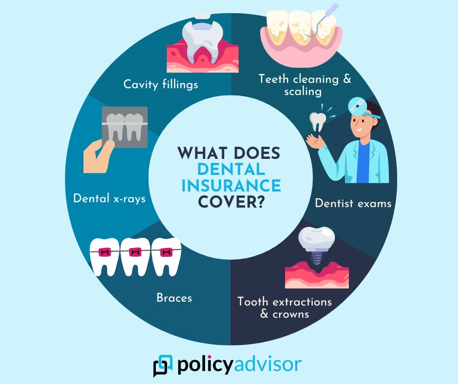 All You Need To Know About : Dental Insurance Coverage Services